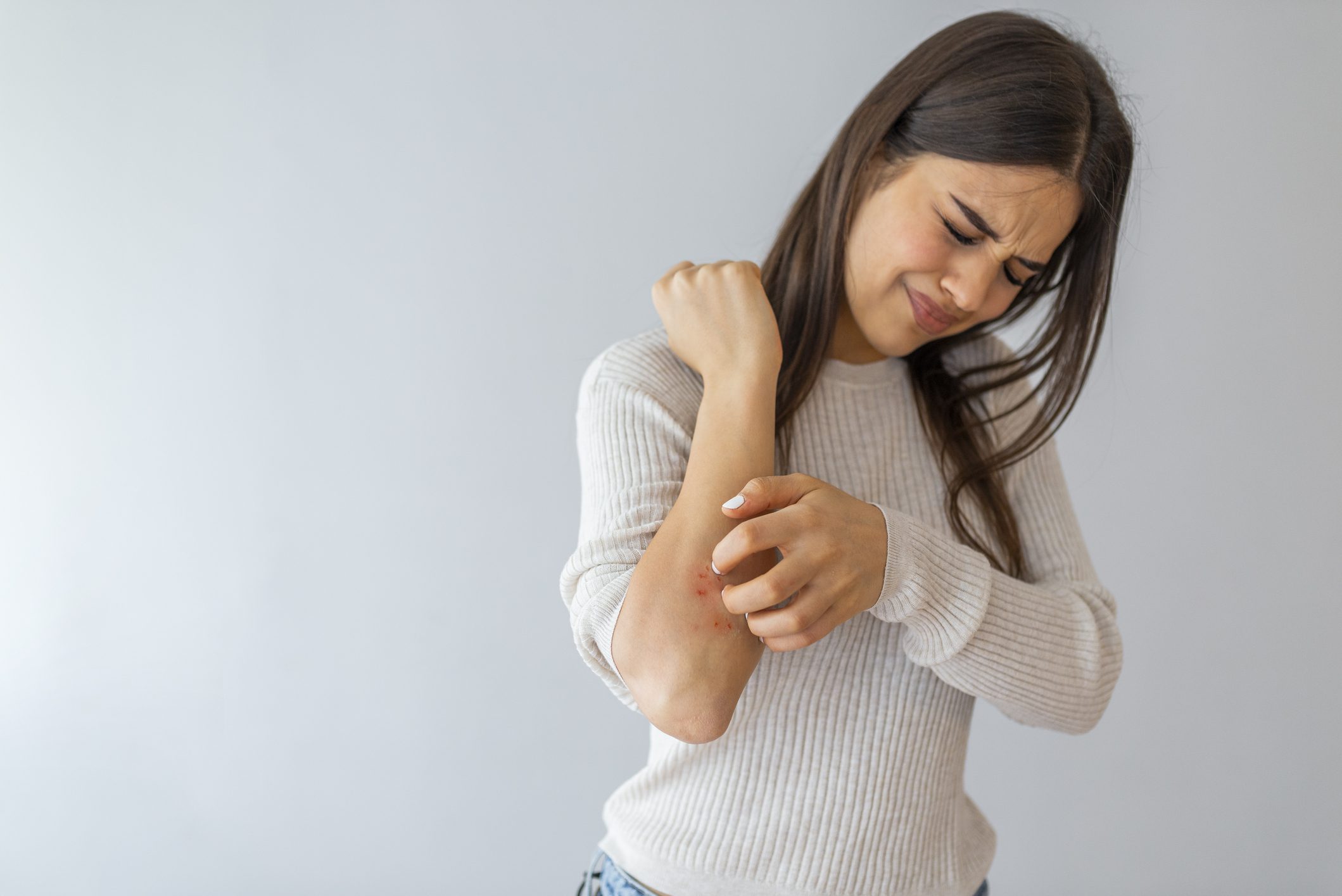 Dermatology psoriasis