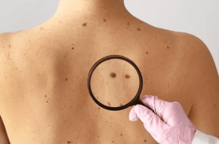 resolution good health dermatologist