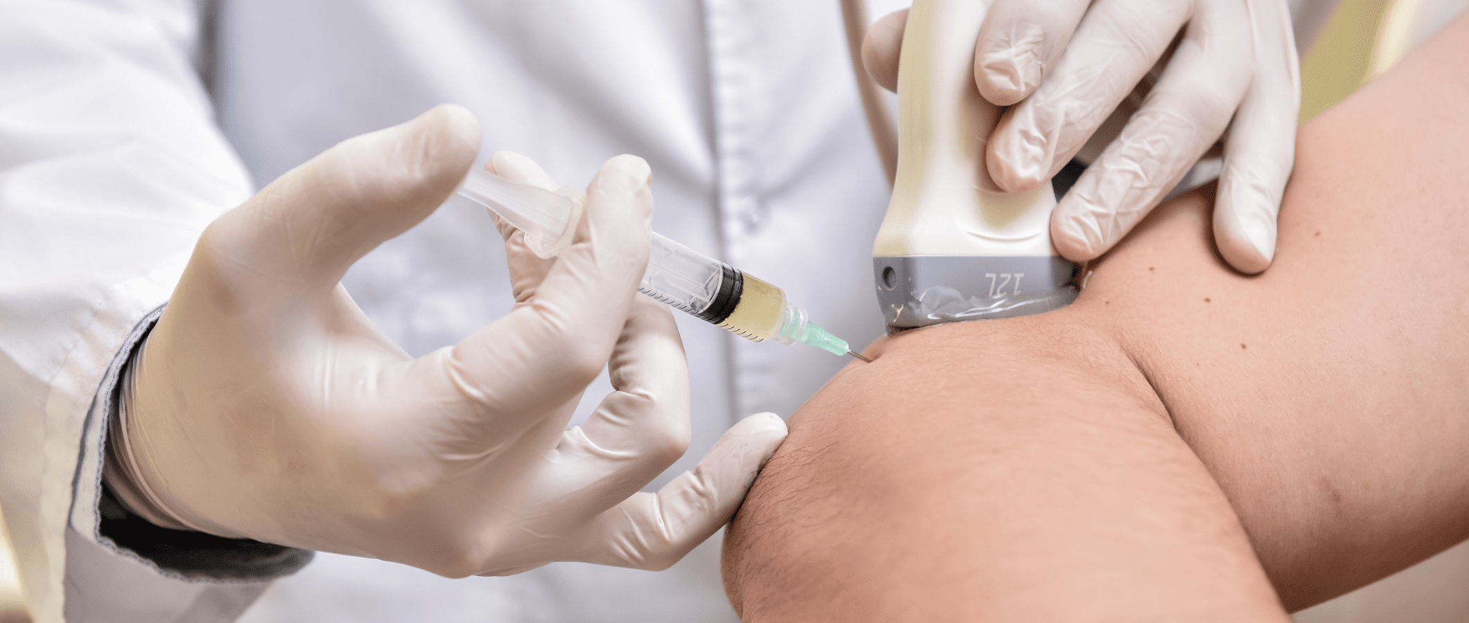 ultrasound-guided infiltration to relieve joint pain or osteoarthritis in the elbow