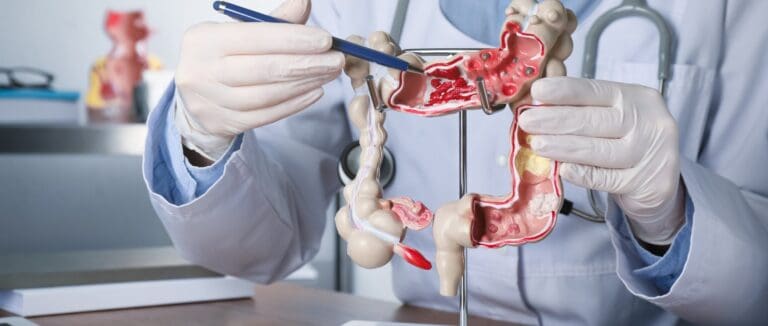 dépistage cancer colorectal